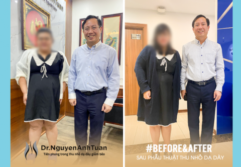 Tăng cân “vù vù” trong nhiều năm tạm biệt 26kg chỉ sau 3 tháng!